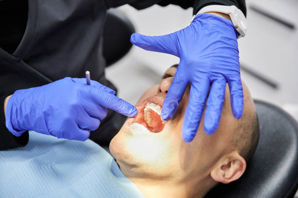 Best Emergency Dentist for Lost Fillings or Crowns in Calcium, NY